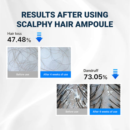 Lumin Hair Cooling Ampoule | Scalp Health & Regrowth 20ml